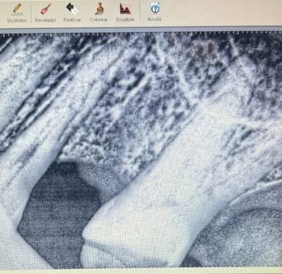 Slider image (1) Smiletec® - Leading Mexicali Dental Clinic